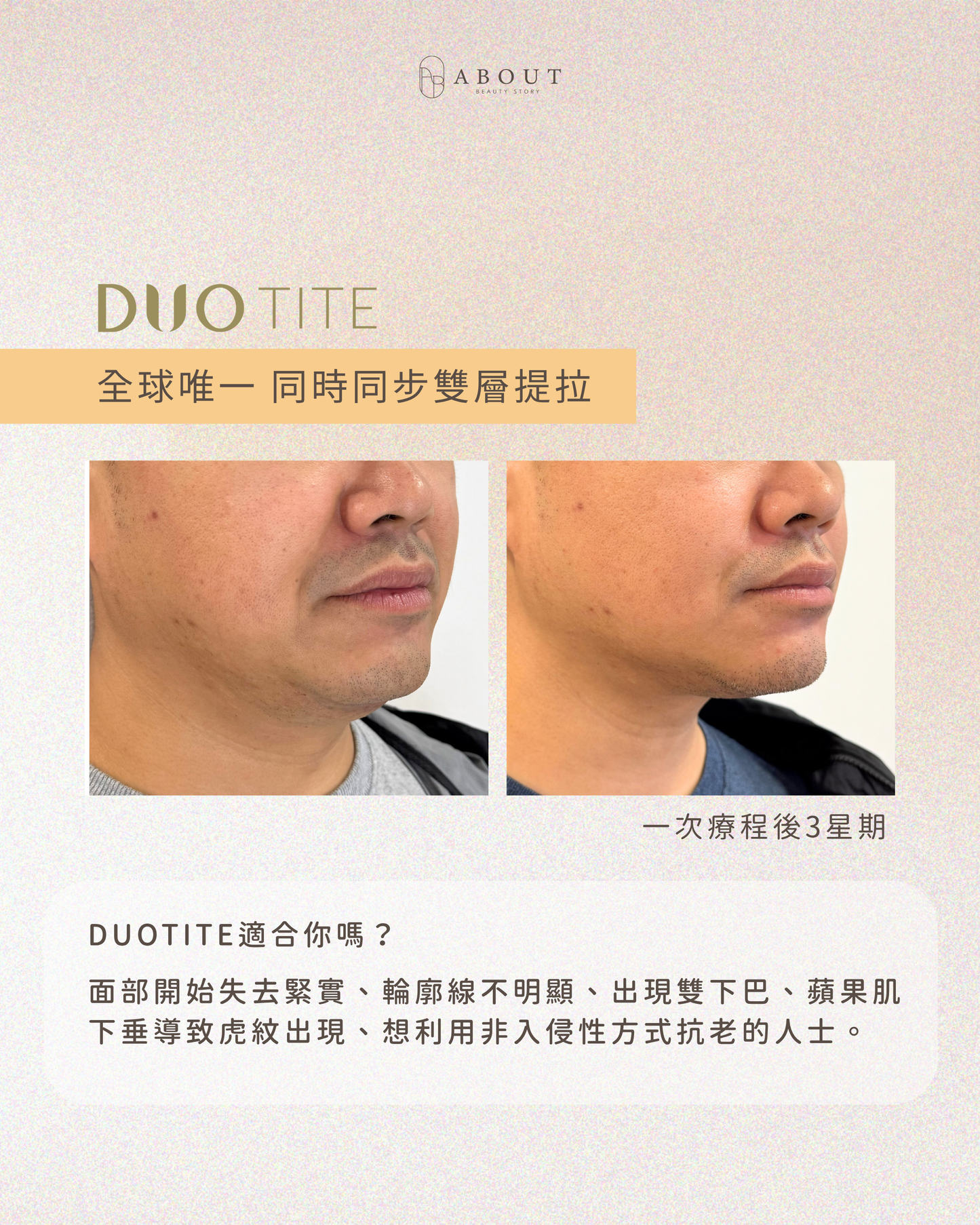 Duotite 矽谷音波
