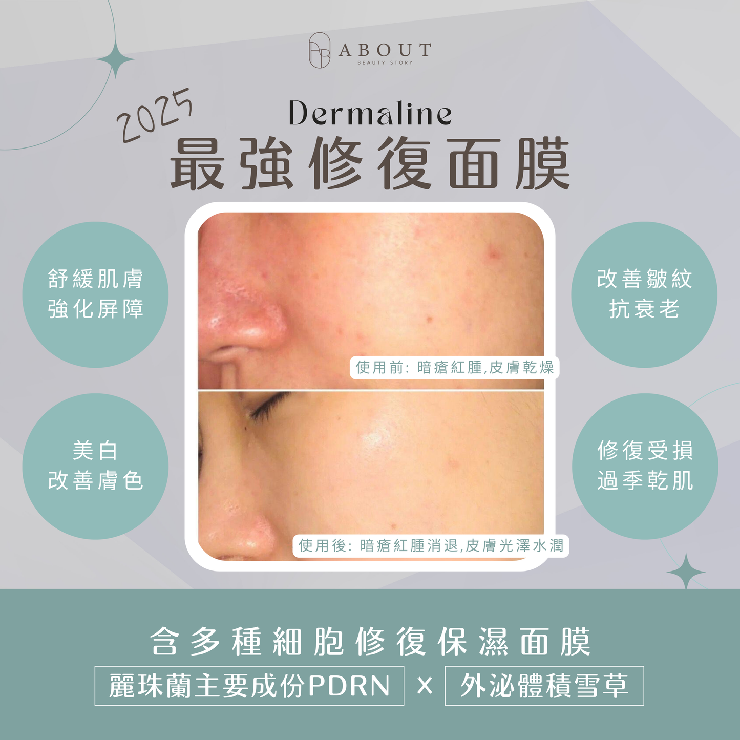 D'LEXO PDRN Mask 積雪草外泌體面膜
