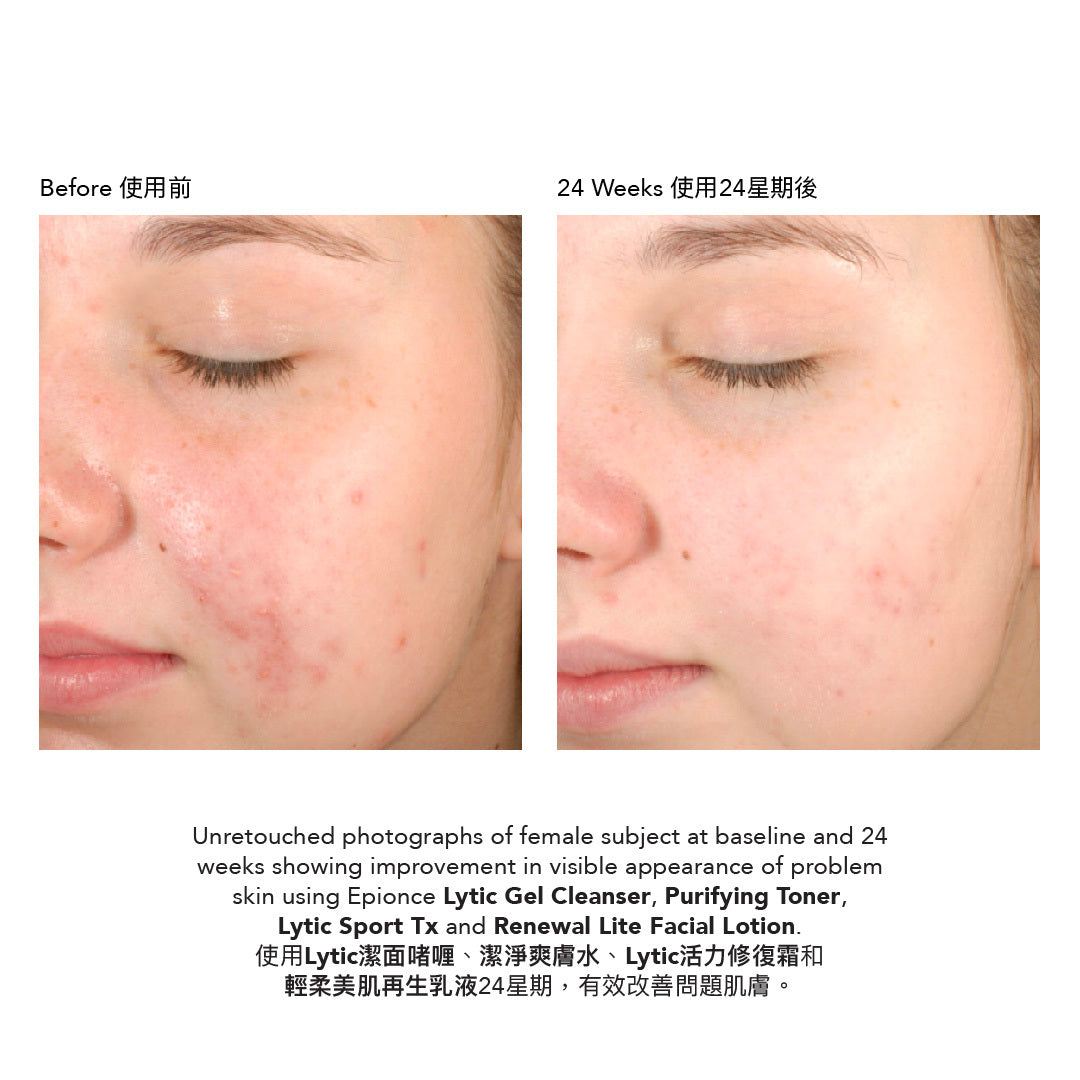 Epionce Renewal Lite Facial Lotion 輕柔美肌再生乳液