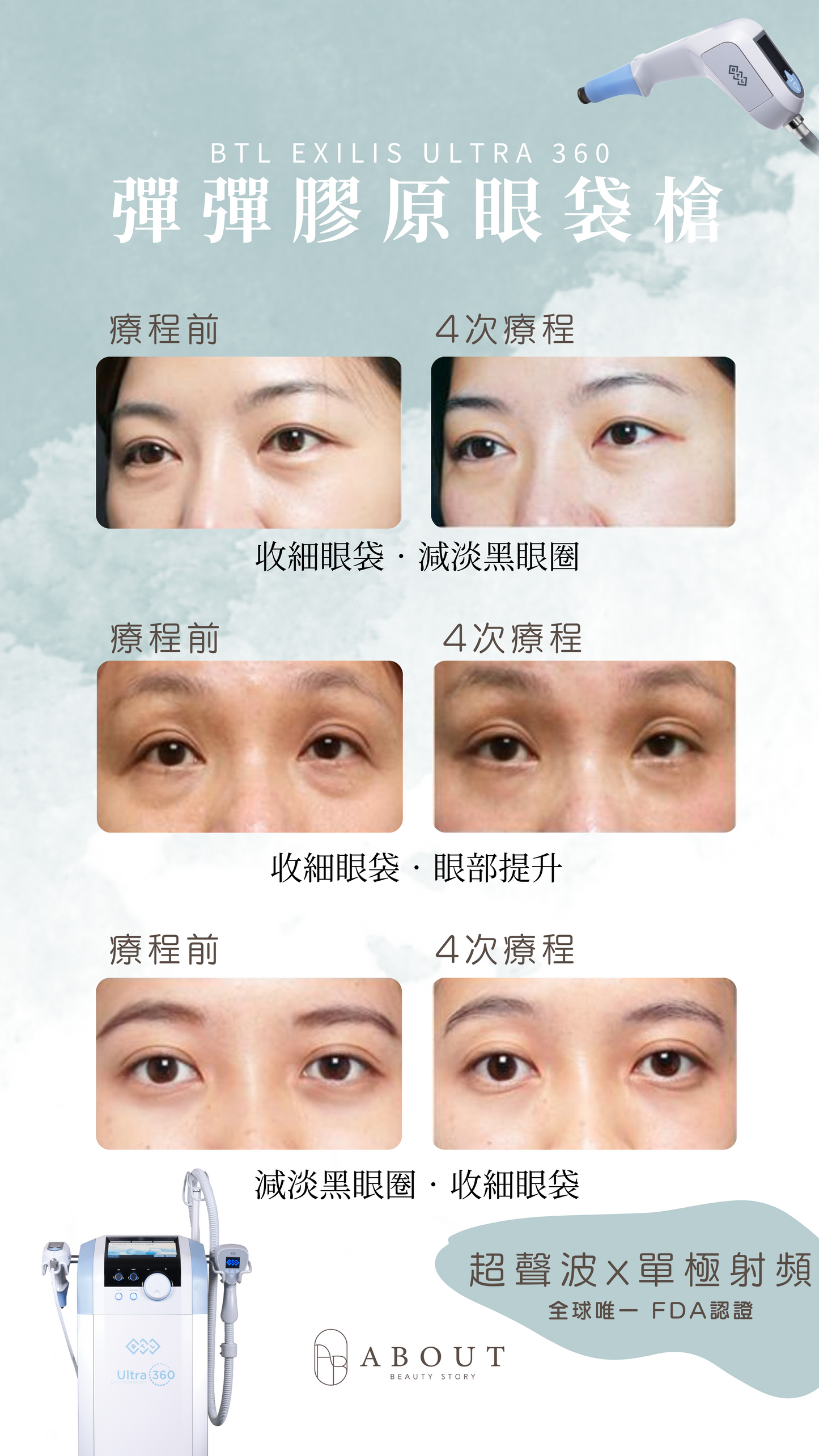 BTL 彈彈膠原眼袋槍 新客優惠碼【EYE380】