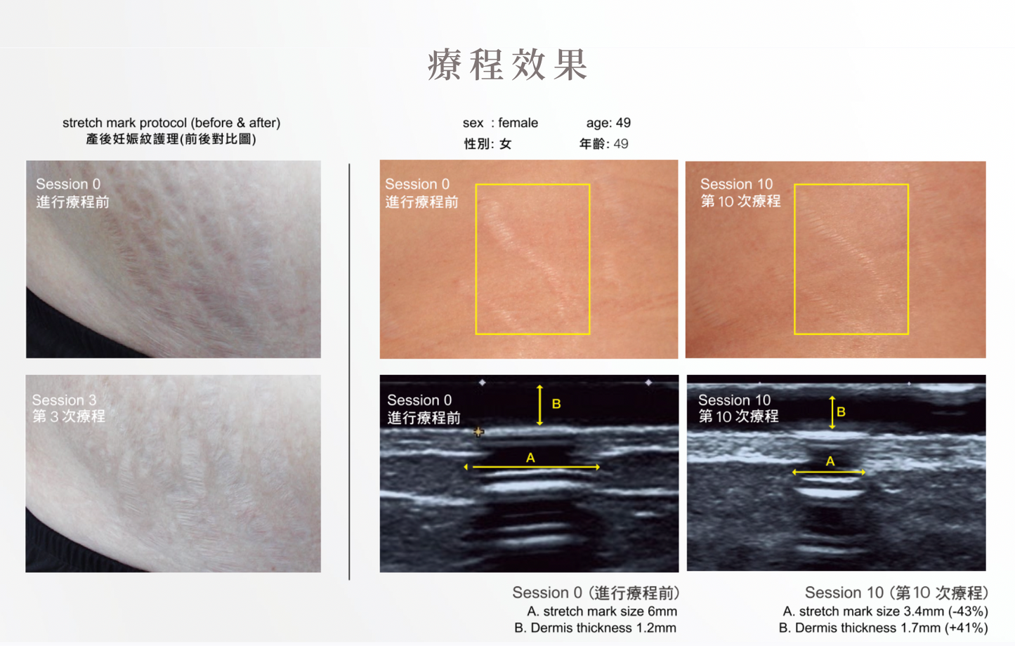 m.pen 精華滲透術 (Body)