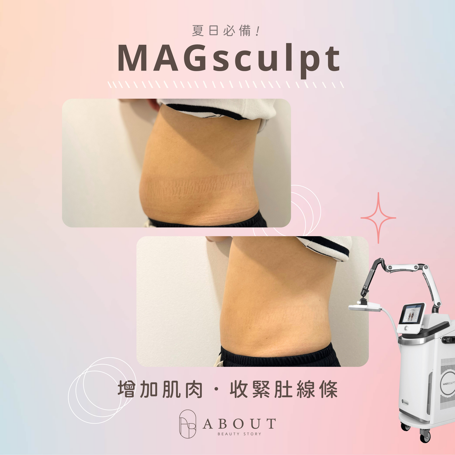 MAGsculpt 雙疊磁頻鍛肌儀