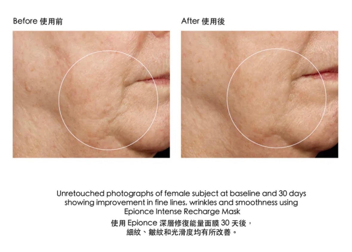 Epionce Intense Recharge Mask 深層修復能量面膜