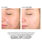 Epionce Renewal Lite Facial Lotion 輕柔美肌再生乳液