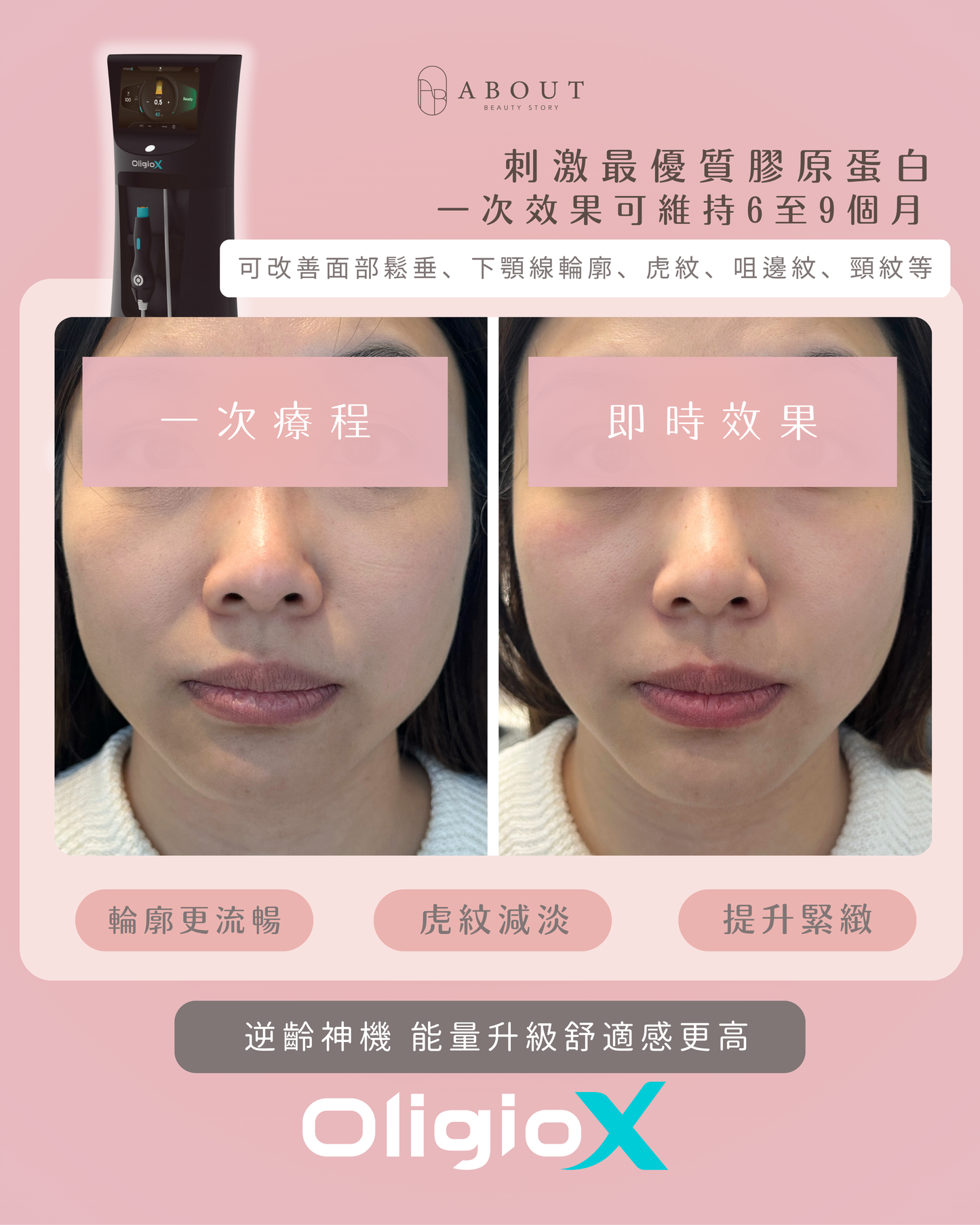 OligioX 原美電波