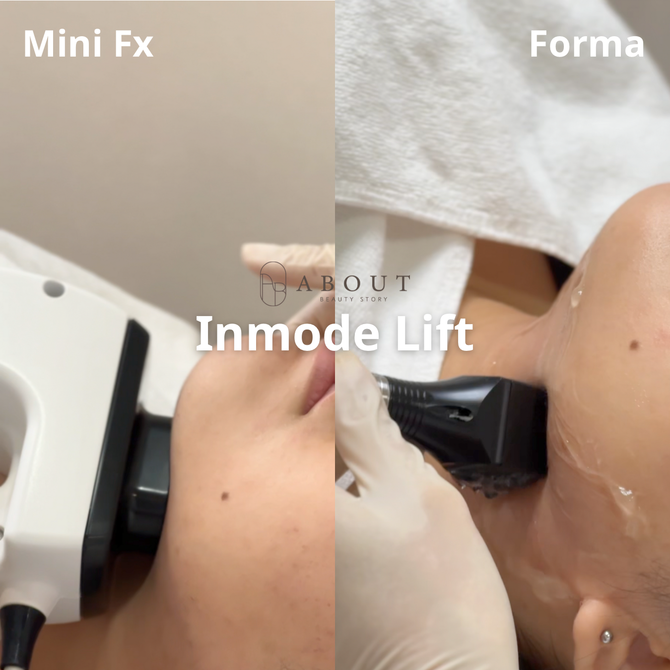 Inmode Lift 鑽石超塑 – ABOUT beauty story