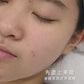 Cocktail Peel 果酸煥膚療程