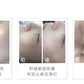 sMTS 嬰兒水晶針療程
